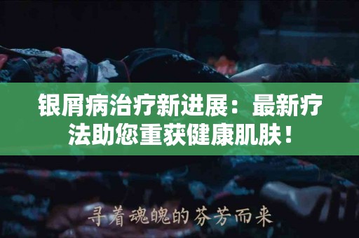 银屑病治疗新进展：最新疗法助您重获健康肌肤！